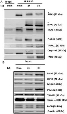 TRIM21, a New Component of the TRAIL-Induced Endogenous Necrosome Complex